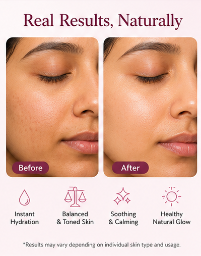 Rose Hydrosol Mist