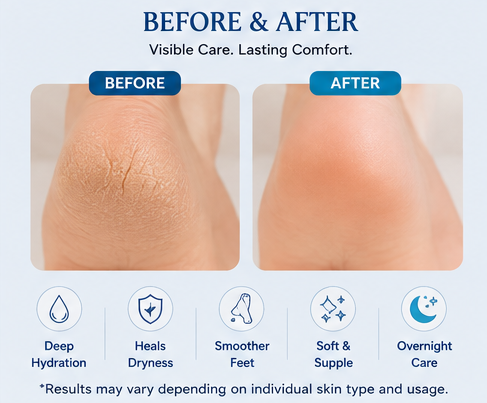 Hershey Hand & Foot Cream | Deep Moisture & Soft Smooth Skin Care
